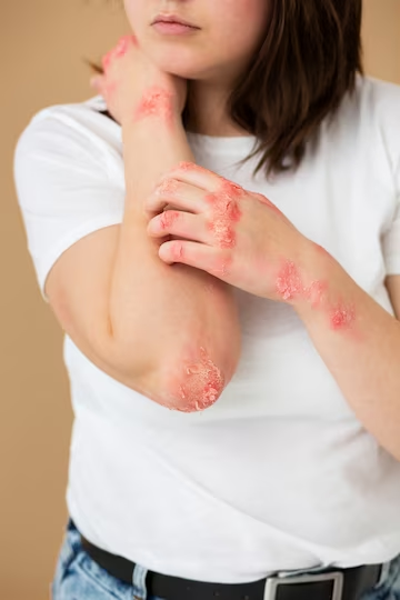 how is hand foot and mouth disease spread